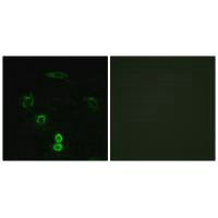 Immunofluorescence analysis of A549 cells, using GLCTK antibody.Rabbit anti-Human GLYCTK Polyclonal Antibody