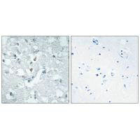 Immunohistochemistry analysis of paraffin-embedded human brain tissue using GLCTK antibody.Rabbit anti-Human GLYCTK Polyclonal Antibody