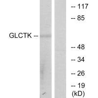 Western blot analysis of extracts from 3T3 cells, using GLCTK antibody.Rabbit anti-Human GLYCTK Polyclonal Antibody