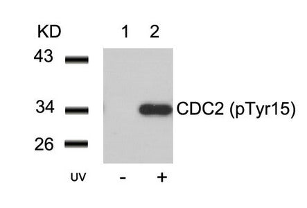 Western blot analysis of extracts from Hela cells untreated(lane 1) or treated with UV(lane 2) using CDC2(Phospho-Tyr15) Antibody.Rabbit anti-Human CDK1 Polyclonal Antibody