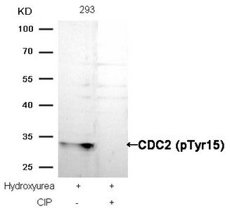 Western blot analysis of extracts from 293 cells, treated with Hydroxyurea or calf intestinal phosphatase (CIP), using CDC2 (Phospho-Tyr15) Antibody.Rabbit anti-Human CDK1 Polyclonal Antibody