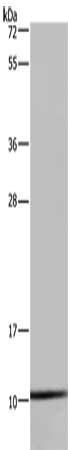 Gel: 10%SDS-PAGE, Lysate: 40 μg, Lane: Hela cells, Primary antibody: NDUFA1 Antibody(NDUFA1 Antibody) at dilution 1/400, Secondary antibody: Goat anti rabbit IgG at 1/8000 dilution, Exposure time: 10 secondsRabbit anti-Human NDUFA1 Polyclonal Antibody