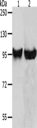 Gel: 8%SDS-PAGE, Lysate: 40 μg, Lane 1-2: HT29 cells, 231 cells, Primary antibody: MMP8 Antibody(MMP8 Antibody) at dilution 1/650, Secondary antibody: Goat anti rabbit IgG at 1/8000 dilution, Exposure time: 10 secondsRabbit anti-Human MMP8 Polyclonal Antibody