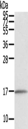Gel: 12%SDS-PAGE, Lysate: 40 μg, Lane: Human normal liver tissue, Primary antibody: EVA1A Antibody(EVA1A Antibody) at dilution 1/550, Secondary antibody: Goat anti rabbit IgG at 1/8000 dilution, Exposure time: 10 secondsRabbit anti-Human EVA1A Polyclonal Antibody
