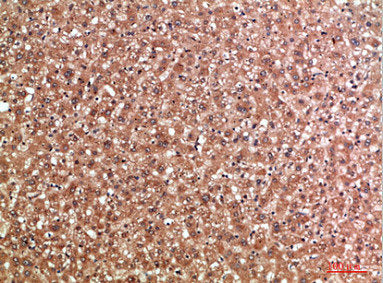 Immunohistochemical analysis of paraffin-embedded human-liver, antibody was diluted at 1:200