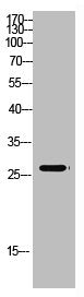 Western Blot analysis of mouse-kidney cells using Antibody diluted at 500. Secondary antibody  was diluted at 1:20000