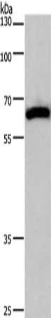 Gel: 6%SDS-PAGE, Lysate: 40 μg, Lane: Mouse brain tissue, Primary antibody: CAMK4 Antibody(CAMK4 Antibody) at dilution 1/200, Secondary antibody: Goat anti rabbit IgG at 1/8000 dilution, Exposure time: 30 seconds