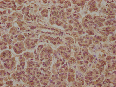 IHC image of SOS2 Antibody diluted at 1:100 and staining in paraffin-embedded human pancreatic tissue performed on a Leica BondTM system. After dewaxing and hydration, antigen retrieval was mediated by high pressure in a citrate buffer (pH 6.0). Section was blocked with 10% normal goat serum 30min at RT. Then primary antibody (1% BSA) was incubated at 4°C overnight. The primary is detected by a biotinylated secondary antibody and visualized using an HRP conjugated SP system.Rabbit anti-Human SOS2 Polyclonal Antibody