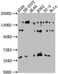 Western Blot | Positive WB detected in: A549 whole cell lysate, SH-SY5Y whole cell lysate, HL60 whole cell lysate, K562 whole cell lysate, PC-3 whole cell lysate, Hela whole cell lysate | All lanes: SOS2 antibody at 1:1000 | Secondary | Goat polyclonal to rabbit IgG at 1/50000 dilution | Predicted band size: 153, 150 kDa | Observed band size: 153 kDaRabbit anti-Human SOS2 Polyclonal Antibody