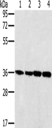 Gel: 8%SDS-PAGE, Lysate: 40 μg, Lane 1-4: 293T cells, K562 cells, 231 cells, hela cells, Primary antibody: MRPL39 Antibody(MRPL39 Antibody) at dilution 1/400, Secondary antibody: Goat anti rabbit IgG at 1/8000 dilution, Exposure time: 5 secondsRabbit anti-Human MRPL39 Polyclonal Antibody