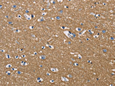 The image on the left is immunohistochemistry of paraffin-embedded Human brain tissue using the antibody Antibody) at dilution 1/50, on the right is treated with fusion protein. (Original magnification: ×200)Rabbit anti-Human GPM6A Polyclonal Antibody