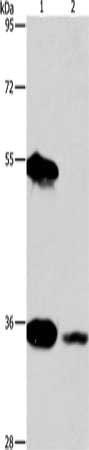 Gel: 8%SDS-PAGE, Lysate: 50 μg, Lane 1-2: Hela cells, Raji cells, Primary antibody: BAG1 Antibody(BAG1 Antibody) at dilution 1/350, Secondary antibody: Goat anti rabbit IgG at 1/8000 dilution, Exposure time: 5 seconds