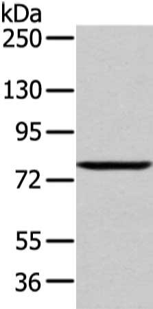 Gel: 6%SDS-PAGE, Lysate: 60 μg, Lane: 293T cell, Primary antibody: WDR91 Antibody(WDR91 Antibody) at dilution 1/400 dilution, Secondary antibody: Goat anti rabbit IgG at 1/8000 dilution, Exposure time: 1 minuteRabbit anti-Human WDR91 Polyclonal Antibody