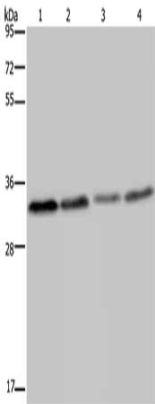 Gel: 10%SDS-PAGE, Lysate: 40 μg, Lane 1-4: Hela cells, human testis tissue, HT29 cells, PC3 cells, Primary antibody: TICAM2 Antibody(TICAM2 Antibody) at dilution 1/200, Secondary antibody: Goat anti rabbit IgG at 1/8000 dilution, Exposure time: 20 secondsRabbit anti-Human TICAM2 Polyclonal Antibody