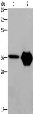 Gel: 8%SDS-PAGE, Lysate: 40 μg, Lane 1-2: Human fetal brain tissue, mouse brain tissue, Primary antibody: CXCR6 Antibody(CXCR6 Antibody) at dilution 1/350, Secondary antibody: Goat anti rabbit IgG at 1/8000 dilution, Exposure time: 2 minutesRabbit anti-Human CXCR6 Polyclonal Antibody