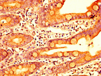 IHC image of ERI1 Antibody diluted at 1:400 and staining in paraffin-embedded human small intestine tissue performed on a Leica BondTM system. After dewaxing and hydration, antigen retrieval was mediated by high pressure in a citrate buffer (pH 6.0). Section was blocked with 10% normal goat serum 30min at RT. Then primary antibody (1% BSA) was incubated at 4°C overnight. The primary is detected by a biotinylated secondary antibody and visualized using an HRP conjugated SP system.Rabbit anti-Human ERI1 Polyclonal Antibody