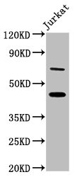 Western Blot | Positive WB detected in: Jurkat whole cell lysate | All lanes: ERI1 antibody at 7μg/ml | Secondary | Goat polyclonal to rabbit IgG at 1/50000 dilution | Predicted band size: 41 kDa | Observed band size: 46 kDaRabbit anti-Human ERI1 Polyclonal Antibody