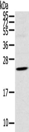 Gel: 12%SDS-PAGE, Lysate: 40 μg, Lane: Human fetal brain tissue, Primary antibody: TSPAN13 Antibody(TSPAN13 Antibody) at dilution 1/550, Secondary antibody: Goat anti rabbit IgG at 1/8000 dilution, Exposure time: 2 minutesRabbit anti-Human TSPAN13 Polyclonal Antibody
