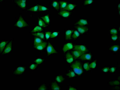 Immunofluorescence staining of Hela cells with IMPDH1 Antibody at 1:200, counter-stained with DAPI. The cells were fixed in 4% formaldehyde, permeabilized using 0.2% Triton X-100 and blocked in 10% normal Goat Serum. The cells were then incubated with the antibody overnight at 4°C. The secondary antibody was Alexa Fluor 488-congugated AffiniPure Goat Anti-Rabbit IgG(H+L).Rabbit anti-Human IMPDH1 Polyclonal Antibody