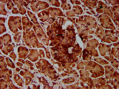 IHC image of IMPDH1 Antibody diluted at 1:600 and staining in paraffin-embedded human pancreatic tissue performed on a Leica BondTM system. After dewaxing and hydration, antigen retrieval was mediated by high pressure in a citrate buffer (pH 6.0). Section was blocked with 10% normal goat serum 30min at RT. Then primary antibody (1% BSA) was incubated at 4°C overnight. The primary is detected by a biotinylated secondary antibody and visualized using an HRP conjugated SP system.Rabbit anti-Human IMPDH1 Polyclonal Antibody