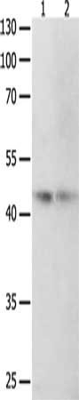 Gel: 10%SDS-PAGE, Lysate: 40 μg, Lane 1-2: 293T cells, NIH/3T3 cells, Primary antibody: MAP2K2 Antibody(MAP2K2 Antibody) at dilution 1/400, Secondary antibody: Goat anti rabbit IgG at 1/8000 dilution, Exposure time: 10 seconds