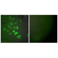Immunofluorescence analysis of A549 cells, using S100 A1 antibody.Rabbit anti-Human S100A1 Polyclonal Antibody