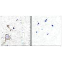Immunohistochemical analysis of paraffin-embedded human brain tissue using S100 A1 antibody.Rabbit anti-Human S100A1 Polyclonal Antibody