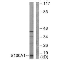 Western blot analysis of extracts from A549 cells, using S100 A1 antibody.Rabbit anti-Human S100A1 Polyclonal Antibody