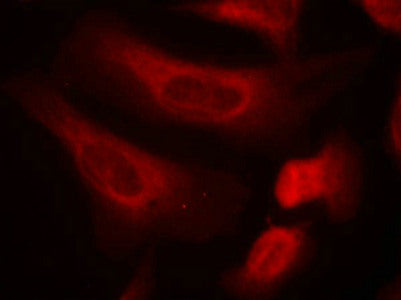 Immunofluorescence staining of methanol-fixed Hela cells using STAT1(Phospho-Ser727) Antibody.Rabbit anti-Human STAT1 Polyclonal Antibody