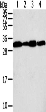Gel: 12%SDS-PAGE, Lysate: 40 μg, Lane 1-4: A375 cells, A431 cells, lovo cells, hela cells, Primary antibody: STX10 Antibody(STX10 Antibody) at dilution 1/800, Secondary antibody: Goat anti rabbit IgG at 1/8000 dilution, Exposure time: 5 secondsRabbit anti-Human STX10 Polyclonal Antibody