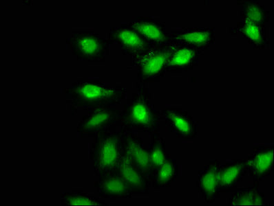 Immunofluorescence staining of Hela cells with AMMECR1 Antibody at 1:66, counter-stained with DAPI. The cells were fixed in 4% formaldehyde, permeabilized using 0.2% Triton X-100 and blocked in 10% normal Goat Serum. The cells were then incubated with the antibody overnight at 4°C. The secondary antibody was Alexa Fluor 488-congugated AffiniPure Goat Anti-Rabbit IgG(H+L).Rabbit anti-Human AMMECR1 Polyclonal Antibody