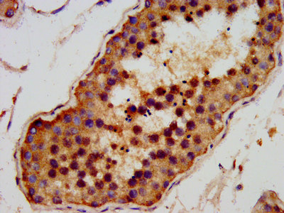 IHC image of AMMECR1 Antibody diluted at 1:200 and staining in paraffin-embedded human testis tissue performed on a Leica BondTM system. After dewaxing and hydration, antigen retrieval was mediated by high pressure in a citrate buffer (pH 6.0). Section was blocked with 10% normal goat serum 30min at RT. Then primary antibody (1% BSA) was incubated at 4°C overnight. The primary is detected by a biotinylated secondary antibody and visualized using an HRP conjugated SP system.Rabbit anti-Human AMMECR1 Polyclonal Antibody