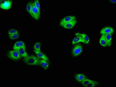 Immunofluorescence staining of HepG2 cells with KCNE3 Antibody at 1:66, counter-stained with DAPI. The cells were fixed in 4% formaldehyde, permeabilized using 0.2% Triton X-100 and blocked in 10% normal Goat Serum. The cells were then incubated with the antibody overnight at 4°C. The secondary antibody was Alexa Fluor 488-congugated AffiniPure Goat Anti-Rabbit IgG(H+L).