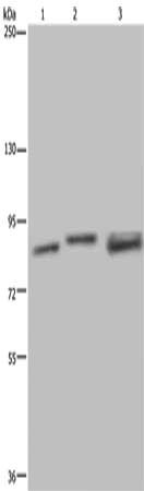 Gel: 6%SDS-PAGE, Lysate: 40 μg, Lane 1-3: Jurkat cells, A172 cells, mouse brain tissue, Primary antibody: NR3C1 Antibody(NR3C1 Antibody) at dilution 1/300, Secondary antibody: Goat anti rabbit IgG at 1/8000 dilution, Exposure time: 2 minutesRabbit anti-Human NR3C1 Polyclonal Antibody