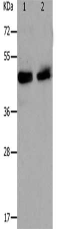 Gel: 10%SDS-PAGE, Lysate: 30 μg, Lane 1-2: Hela cells, A549 cells, Primary antibody: PAWR Antibody(PAWR Antibody) at dilution 1/1200, Secondary antibody: Goat anti rabbit IgG at 1/8000 dilution, Exposure time: 10 secondsRabbit anti-Human PAWR Polyclonal Antibody
