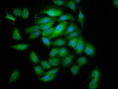 Immunofluorescence staining of A549 cells with CLC Antibody at 1:133, counter-stained with DAPI. The cells were fixed in 4% formaldehyde, permeabilized using 0.2% Triton X-100 and blocked in 10% normal Goat Serum. The cells were then incubated with the antibody overnight at 4°C. The secondary antibody was Alexa Fluor 488-congugated AffiniPure Goat Anti-Rabbit IgG(H+L).Rabbit anti-Human CLC Polyclonal Antibody