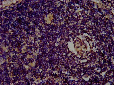 IHC image of the antibody diluted at 1:400 and staining in paraffin-embedded human lymph node tissue performed on a Leica BondTM system. After dewaxing and hydration, antigen retrieval was mediated by high pressure in a citrate buffer (pH 6.0). Section was blocked with 10% normal goat serum 30min at RT. Then primary antibody (1% BSA) was incubated at 4°C overnight. The primary is detected by a biotinylated secondary antibody and visualized using an HRP conjugated SP system.Rabbit anti-Human CLC Polyclonal Antibody