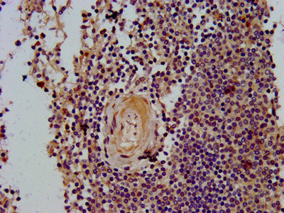 IHC image of CLC Antibody diluted at 1:400 and staining in paraffin-embedded human spleen tissue performed on a Leica BondTM system. After dewaxing and hydration, antigen retrieval was mediated by high pressure in a citrate buffer (pH 6.0). Section was blocked with 10% normal goat serum 30min at RT. Then primary antibody (1% BSA) was incubated at 4°C overnight. The primary is detected by a biotinylated secondary antibody and visualized using an HRP conjugated SP system.Rabbit anti-Human CLC Polyclonal Antibody
