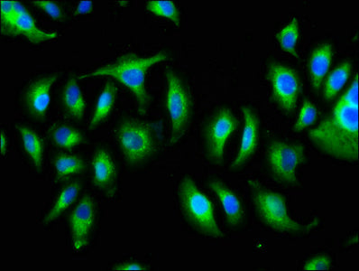 Immunofluorescence staining of A549 cells with KIAA0319 Antibody at 1:166, counter-stained with DAPI. The cells were fixed in 4% formaldehyde, permeabilized using 0.2% Triton X-100 and blocked in 10% normal Goat Serum. The cells were then incubated with the antibody overnight at 4°C. The secondary antibody was Alexa Fluor 488-congugated AffiniPure Goat Anti-Rabbit IgG(H+L).