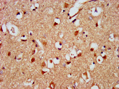 IHC image of KIAA0319 Antibody diluted at 1:500 and staining in paraffin-embedded human brain tissue performed on a Leica BondTM system. After dewaxing and hydration, antigen retrieval was mediated by high pressure in a citrate buffer (pH 6.0). Section was blocked with 10% normal goat serum 30min at RT. Then primary antibody (1% BSA) was incubated at 4°C overnight. The primary is detected by a biotinylated secondary antibody and visualized using an HRP conjugated SP system.