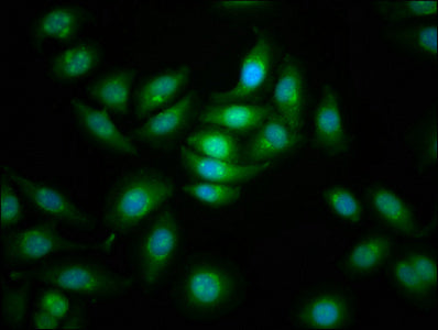Immunofluorescence staining of A549 cells with CDC42BPB Antibody at 1:166, counter-stained with DAPI. The cells were fixed in 4% formaldehyde, permeabilized using 0.2% Triton X-100 and blocked in 10% normal Goat Serum. The cells were then incubated with the antibody overnight at 4°C. The secondary antibody was Alexa Fluor 488-congugated AffiniPure Goat Anti-Rabbit IgG(H+L).Rabbit anti-Human CDC42BPB Polyclonal Antibody