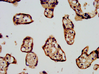 IHC image of the antibody diluted at 1:500 and staining in paraffin-embedded human placenta tissue performed on a Leica BondTM system. After dewaxing and hydration, antigen retrieval was mediated by high pressure in a citrate buffer (pH 6.0). Section was blocked with 10% normal goat serum 30min at RT. Then primary antibody (1% BSA) was incubated at 4°C overnight. The primary is detected by a biotinylated secondary antibody and visualized using an HRP conjugated SP system.Rabbit anti-Human CDC42BPB Polyclonal Antibody