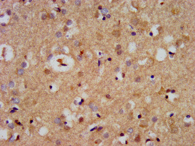 IHC image of CDC42BPB Antibody diluted at 1:500 and staining in paraffin-embedded human brain tissue performed on a Leica BondTM system. After dewaxing and hydration, antigen retrieval was mediated by high pressure in a citrate buffer (pH 6.0). Section was blocked with 10% normal goat serum 30min at RT. Then primary antibody (1% BSA) was incubated at 4°C overnight. The primary is detected by a biotinylated secondary antibody and visualized using an HRP conjugated SP system.Rabbit anti-Human CDC42BPB Polyclonal Antibody