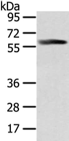 Gel: 8%SDS-PAGE, Lysate: 40 μg, Lane: A375 cell, Primary antibody: PPP5C Antibody(PPP5C Antibody) at dilution 1/300 dilution, Secondary antibody: Goat anti rabbit IgG at 1/8000 dilution, Exposure time: 30 secondsRabbit anti-Human PPP5C Polyclonal Antibody
