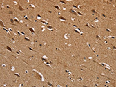 The image on the left is immunohistochemistry of paraffin-embedded Human brain  tissue using NDUFS1 Antibody(NDUFS1 Antibody) at dilution 1/50, on the right is treated with fusion protein. (Original magnification: ×200)Rabbit anti-Human NDUFS1 Polyclonal Antibody