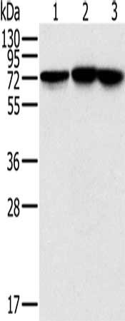 Gel: 10%SDS-PAGE, Lysate: 40 μg, Lane 1-3: Raji cells, Jurkat cells, hela cells, Primary antibody: NDUFS1 Antibody(NDUFS1 Antibody) at dilution 1/800, Secondary antibody: Goat anti rabbit IgG at 1/8000 dilution, Exposure time: 10 secondsRabbit anti-Human NDUFS1 Polyclonal Antibody
