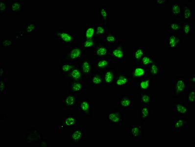 Immunofluorescence staining of Hela cells with GABPA Antibody at 1:67, counter-stained with DAPI. The cells were fixed in 4% formaldehyde, permeabilized using 0.2% Triton X-100 and blocked in 10% normal Goat Serum. The cells were then incubated with the antibody overnight at 4°C. The secondary antibody was Alexa Fluor 488-congugated AffiniPure Goat Anti-Rabbit IgG(H+L).Rabbit anti-Human GABPA Polyclonal Antibody