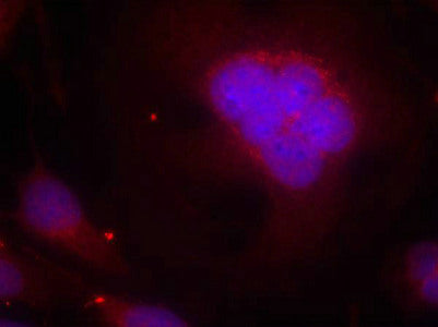 Immunofluorescence staining of methanol-fixed Hela cells using FKHR(Ab-256) Antibody.Rabbit anti-Human FOXO1 Polyclonal Antibody