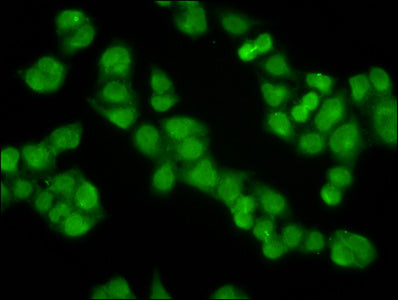 Immunofluorescence staining of Hela cells with KLHL20 Antibody at 1:100, counter-stained with DAPI. The cells were fixed in 4% formaldehyde, permeabilized using 0.2% Triton X-100 and blocked in 10% normal Goat Serum. The cells were then incubated with the antibody overnight at 4°C. The secondary antibody was Alexa Fluor 488-congugated AffiniPure Goat Anti-Rabbit IgG(H+L).