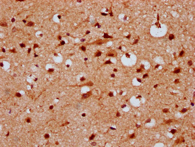 IHC image of the antibody diluted at 1:300 and staining in paraffin-embedded human brain tissue performed on a Leica BondTM system. After dewaxing and hydration, antigen retrieval was mediated by high pressure in a citrate buffer (pH 6.0). Section was blocked with 10% normal goat serum 30min at RT. Then primary antibody (1% BSA) was incubated at 4°C overnight. The primary is detected by a biotinylated secondary antibody and visualized using an HRP conjugated SP system.